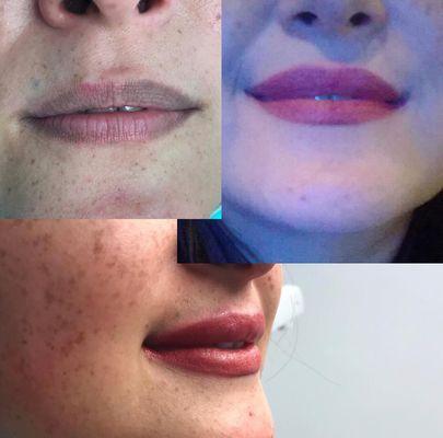 Micropicmentacion de labios con efecto relleno