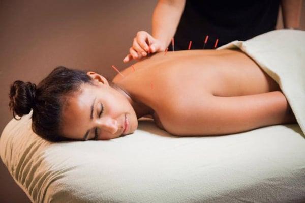 Acupuncture treats chronic pain, fertility, insomnia, anxiety, headaches, and much more.