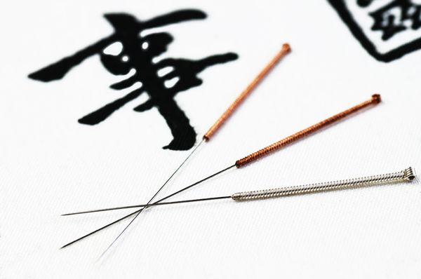 Acupuncture