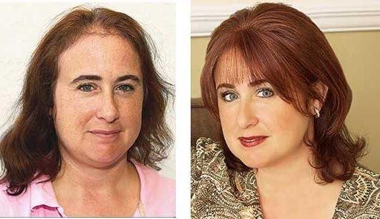 100% Human Hair Restoration - Integrates with your own hair