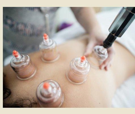 Cupping therapy