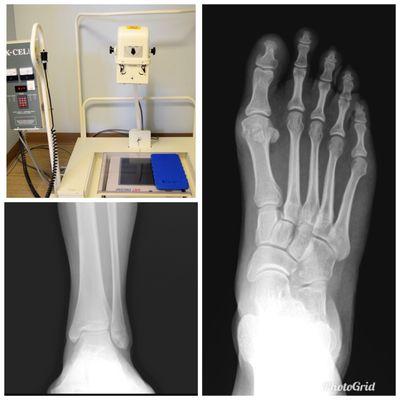 In-office digital X-Rays with immediate results.