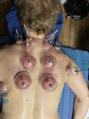 Cupping has the same results as Deep Tissue, using suction instead of pointed pressure