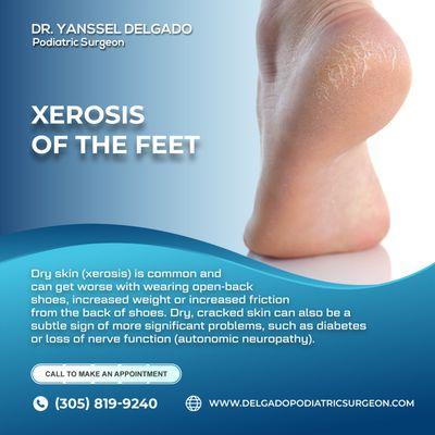 Dry skin (anhidrosis, xerosis) commonly affects the feet of many patients. In people with diabetes, dry skin has the potential to...