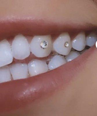 Tooth Gems