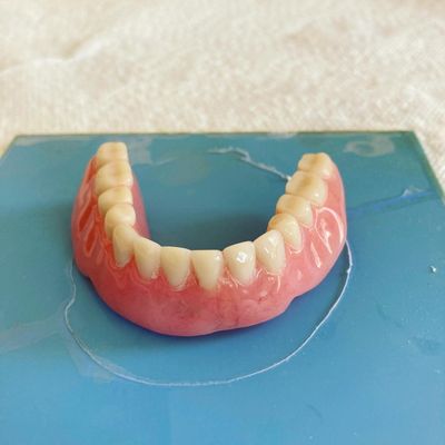 Affordable Denture Repair