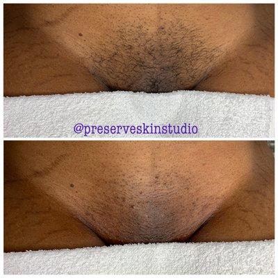 Preserve Skin Studio