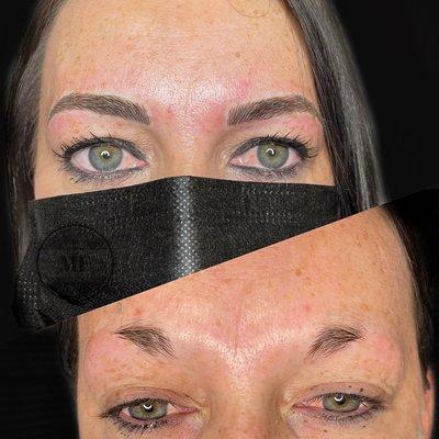 Microblading before & after