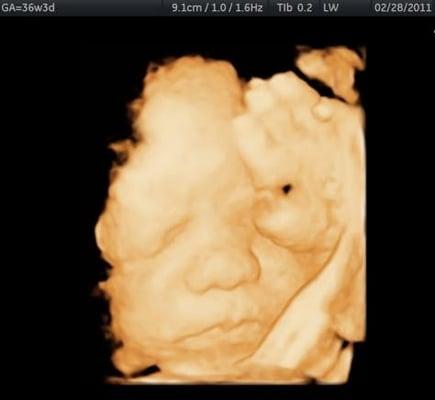 My lil guy at 36 weeks... trying to avoid the camera. haha