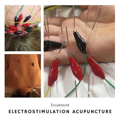 Uses needles in each meridian point, or acupuncture point, and then connects to a machine that passes a small electric current.