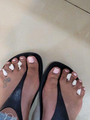 The way my toes came out.