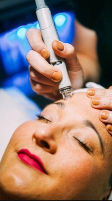 Hydrafacial is the best treatment for exfoliation, extractions, and reviving the skin.