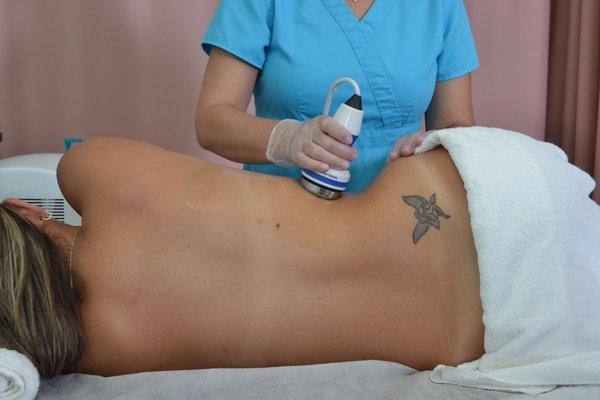 Cavitation therapy for Post surgery and body contour therapies - Cavitacion ayuda a la recuperacion despues de una cirugia.