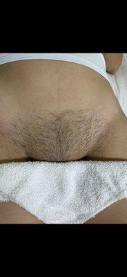 Before a Brazilian wax