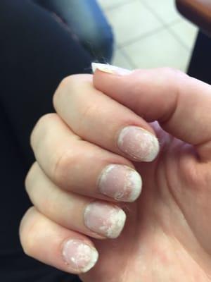 Ruined my nails when scraping off gel