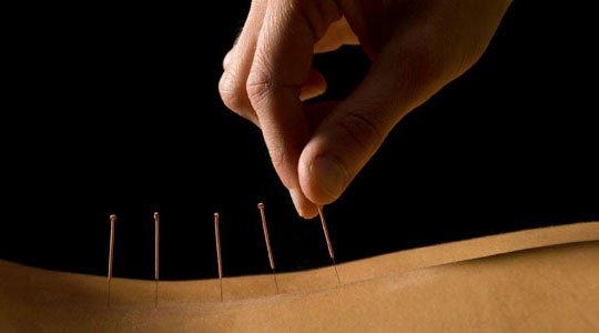 Thousands of years old, Acupuncture is safe, painless and covered by most insurance.  We use only single use, sterile, disposable needles.