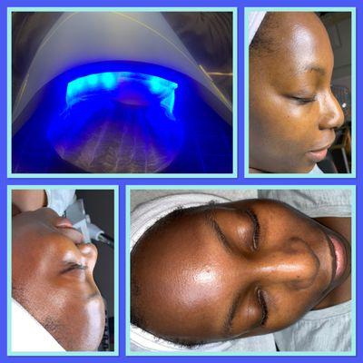 LED Light Therapy