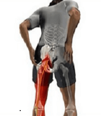 sciatic pain