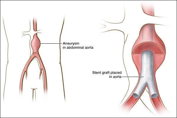 Vascular & Interventional Radiology