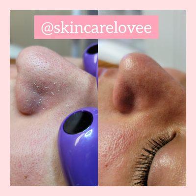 SkincareLove