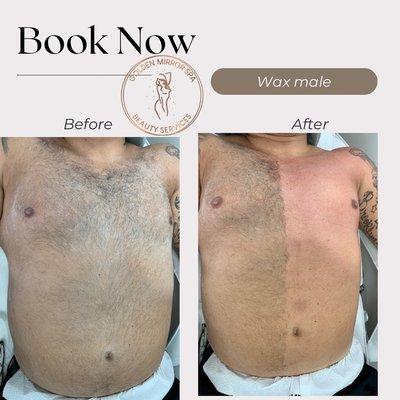 Brazilian waxing for men