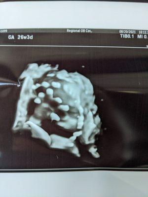 3d photo of the little one