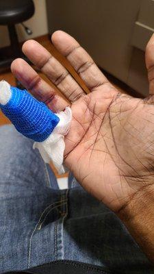 Overkill bandage from finger cut billed as surgery (see other photo