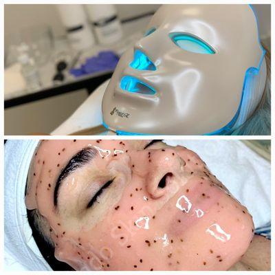 Led light hydrojelly facial