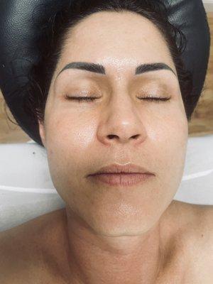 Deep Skin Cleansing, Carbon Peeling, Face Lifting, Dermaplaning and Microneedling