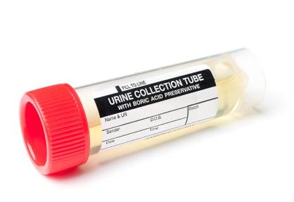 Urine drug testing