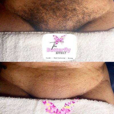 Brazilian wax