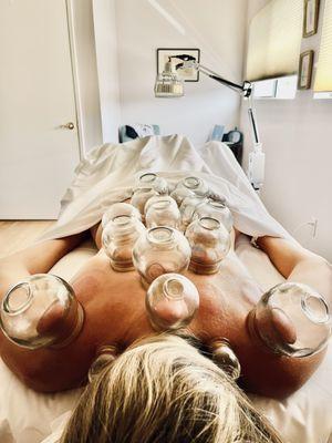 Fire cupping sessions come with a 10 minute hand massage