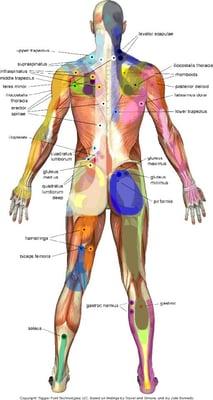 Common Myofascial Trigger Points of the back