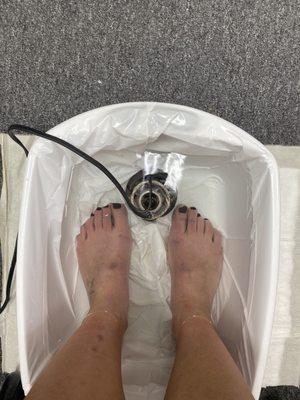 Foot detox is amazing! This is the before. After looks too gross to post