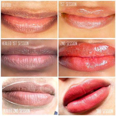 Lip Neutralization with lip blush