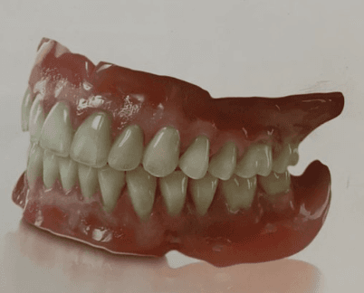 full denture