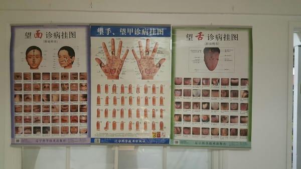 Traditional Chinese Medicine (TCM) Charts of how the body, ie. tongue, face & hands help diagnose diseases & ailments.