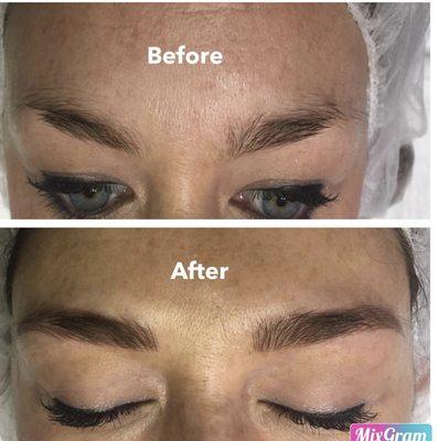 Microblading