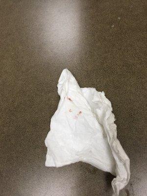 The attendant threw out the other tissues with more blood before I had a chance to take a pic.