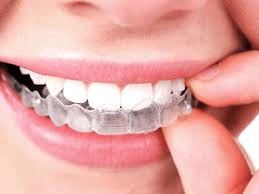 We offer invisible braces!  Contact us today for a free consultation.