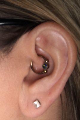 This is a picture of my daith piercing.