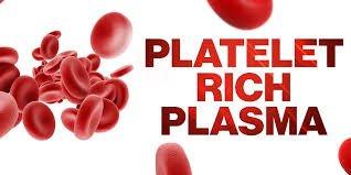 Platelet Rich Plasma