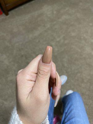 Discoloration of the nails color