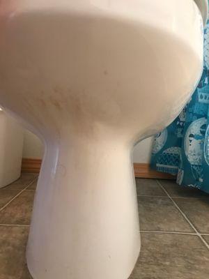 Urine stains under toilet