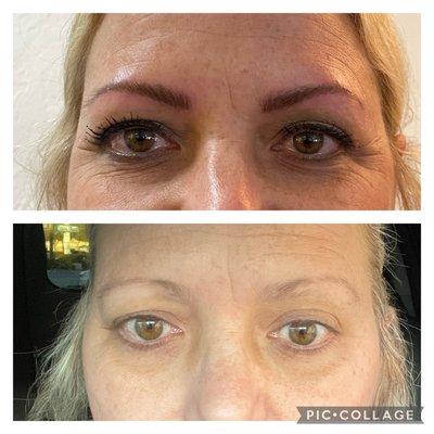 Microblading