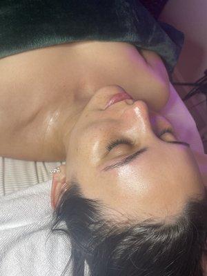 Post Dermaplane Facial
 #dermaplane