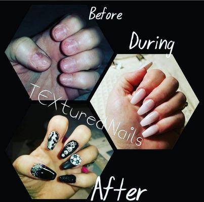 Before and after set of nails