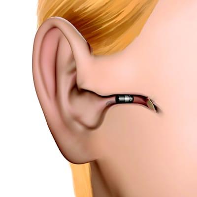 Ears 2 U Hearing Aid Center