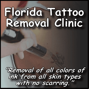 Florida Tattoo Removal Clinic