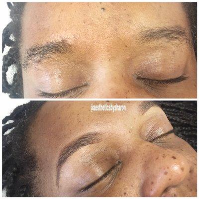 Before and After Brow Makeover @aestheticsbysharon